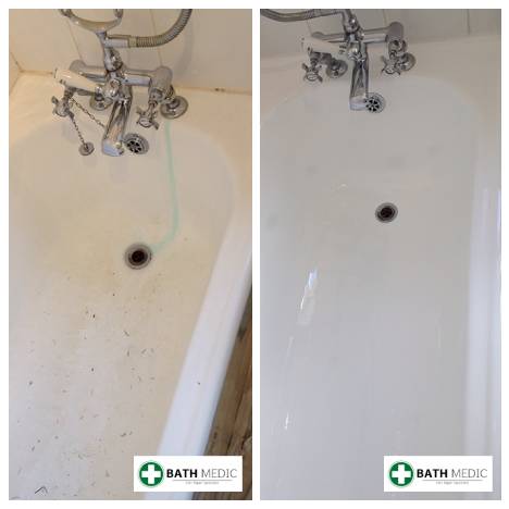 Bath chip repair Manchester Radisson Hotel — Bath Medic