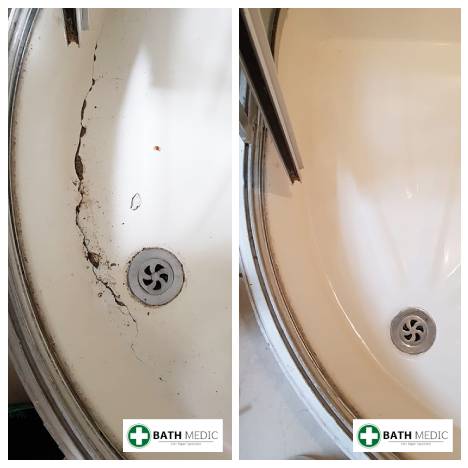 Shower tray repair Manchester listed building — Bath Medic