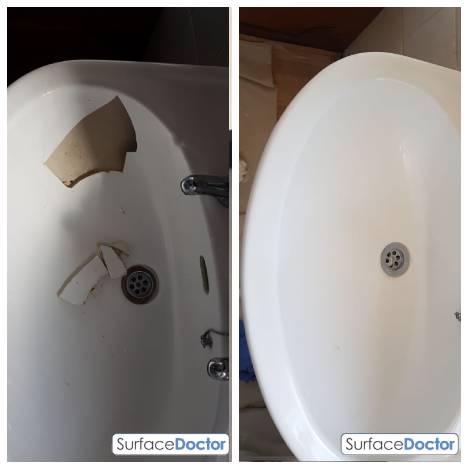 Ceramic sink re-enamelling Manchester specialist work demonstration - Surface Doctor expert applying precision enamel coating using professional spray equipment for factory-quality finish in Didsbury kitchen